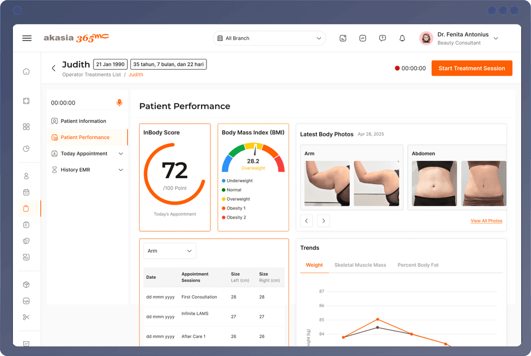 Akasia 365mc Preview